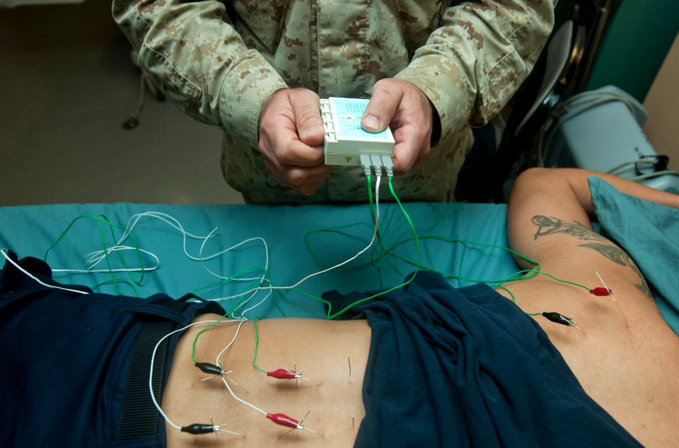 Flickr - Official U.S. Navy Imagery - Cmdr. Yevsey Goldberg conducts an acupuncture procedure. (1)
