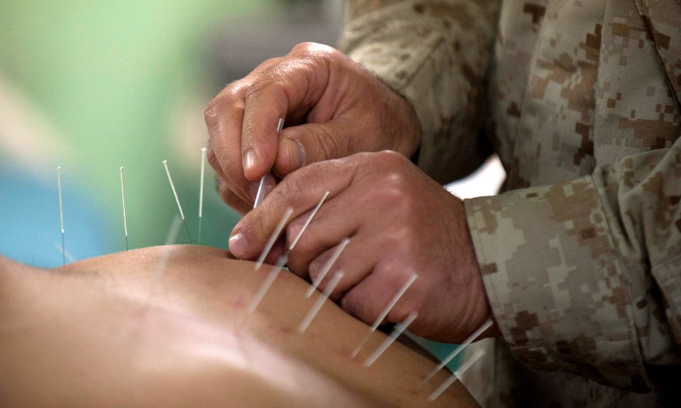 Flickr - Official U.S. Navy Imagery - Cmdr. Yevsey Goldberg conducts an acupuncture procedure.