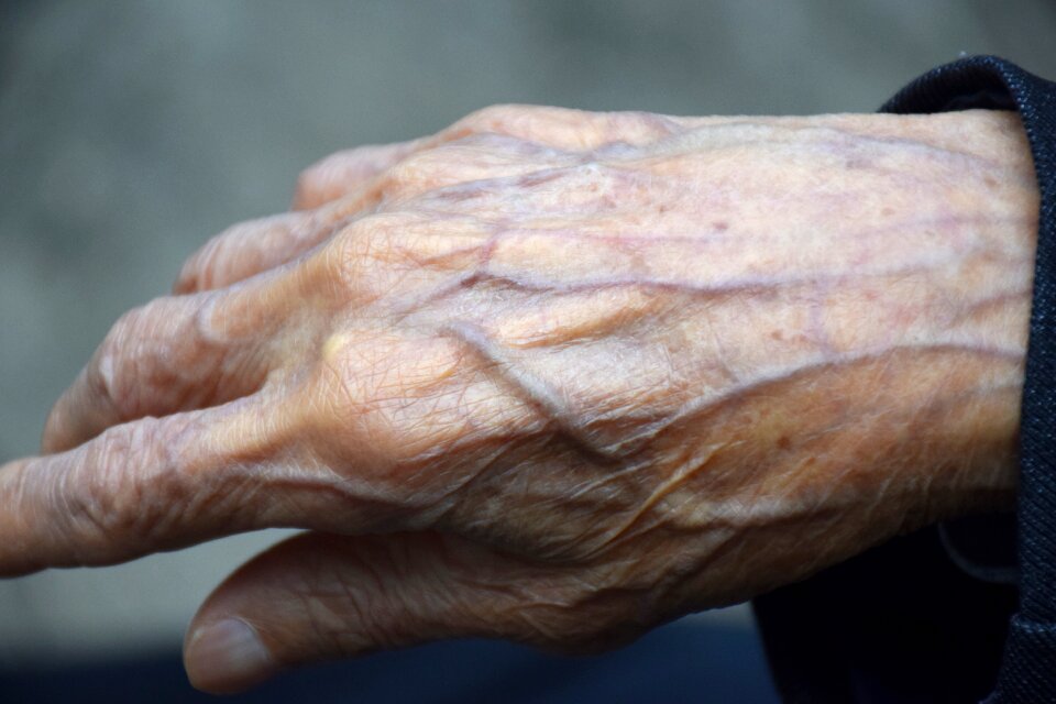 The aged hand meridian