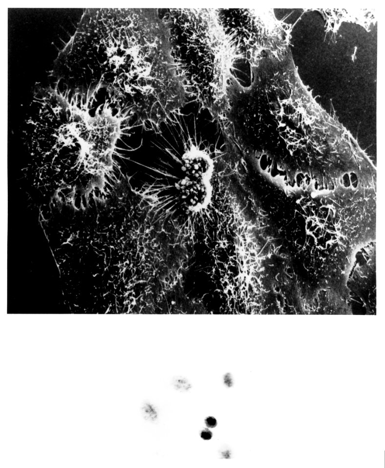 Hela cells with adenovirus