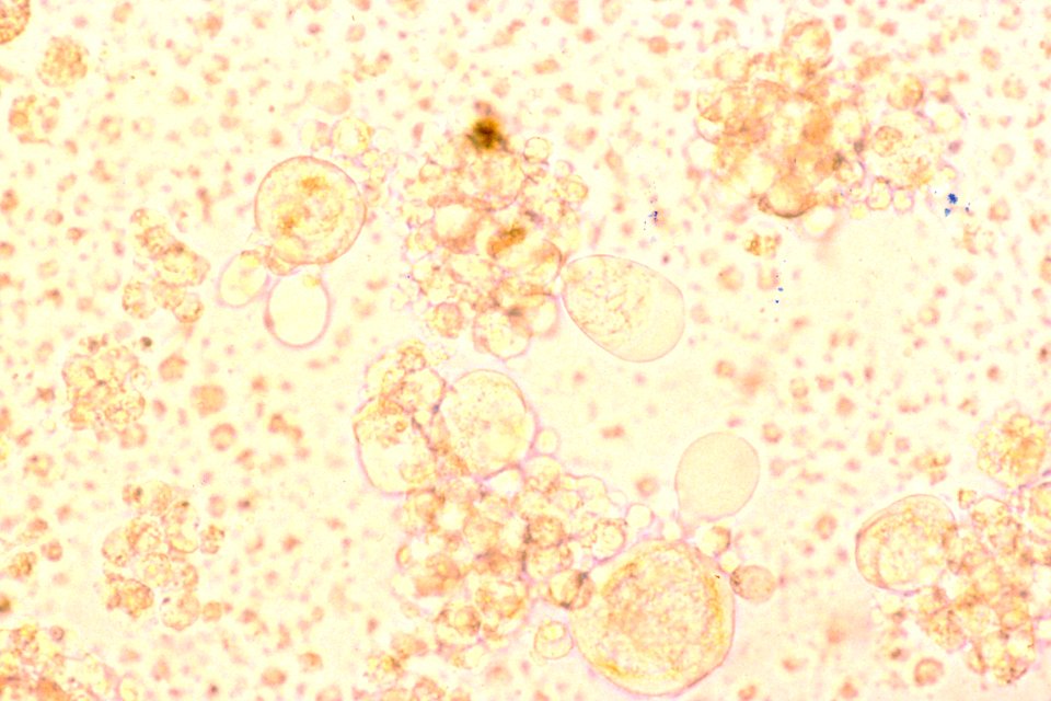 Hhv-6- tissue culture
