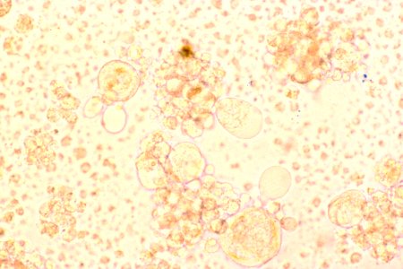 Hhv-6- tissue culture