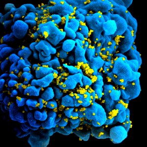 HIV H9 T-cell photo