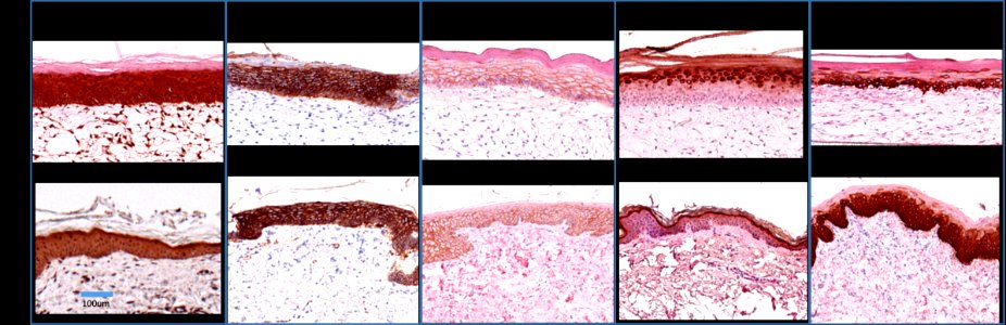 Histology of 3-D Bioprinted Skin (42621985651)