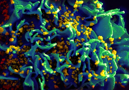 HIV H9 T-cell II