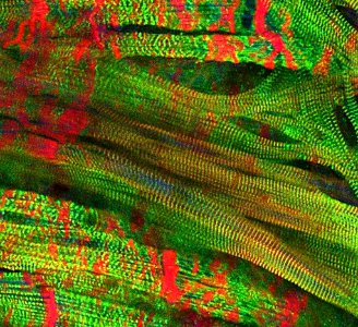 Human Cardiac Tissue Chip (47473708501)