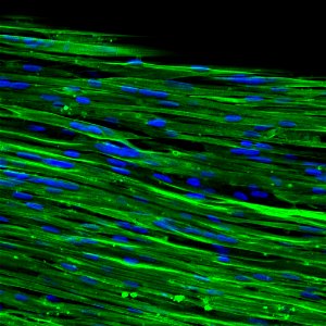 Human Muscle Chip (47420765402)