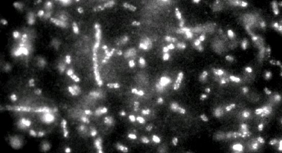 Identifying Bacteria with Quantum Dots (5887835772)