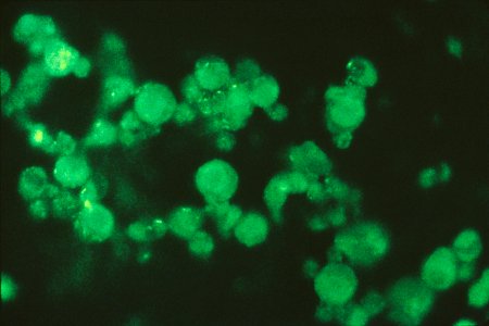 Immunofluorescence (negative)
