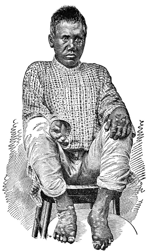 Kaapu. CASE XII. (Photograph 10)