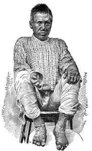 Kaapu. CASE XII. (Photograph 10)