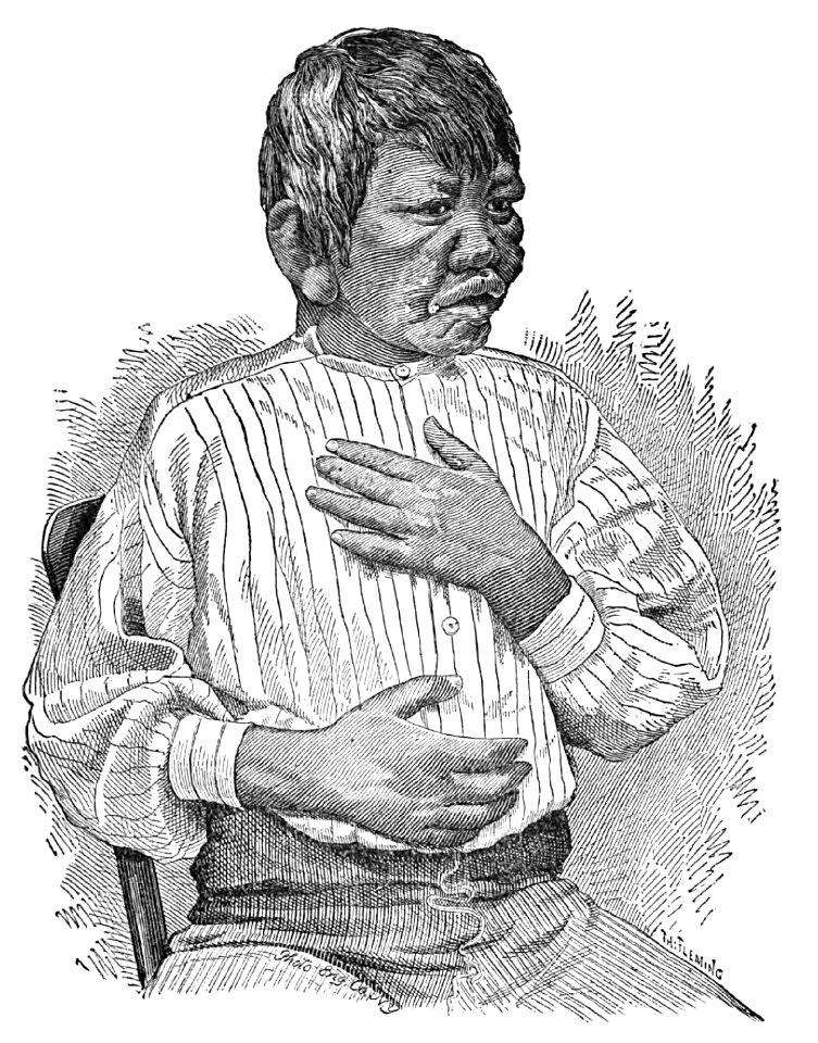 Kaluhi. Case VIII. (Photograph 4)