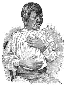Kaluhi. Case VIII. (Photograph 4)