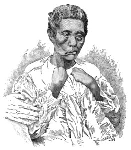 Kalamau. CASE IX. (Photograph 5)