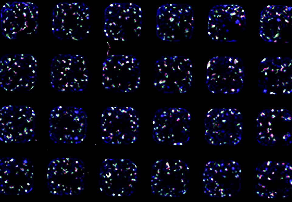 Kidney Organoids (46580296595)