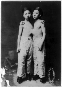 Korean Siamese twins standing nude from waist up with hands on each others' shoulders LCCN2006682711 photo
