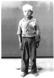 Little injured neapolitan boy from kindergarten ship Caracciolo