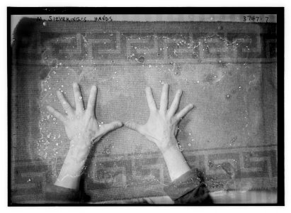 M. Sieveking's hands LCCN2014700933