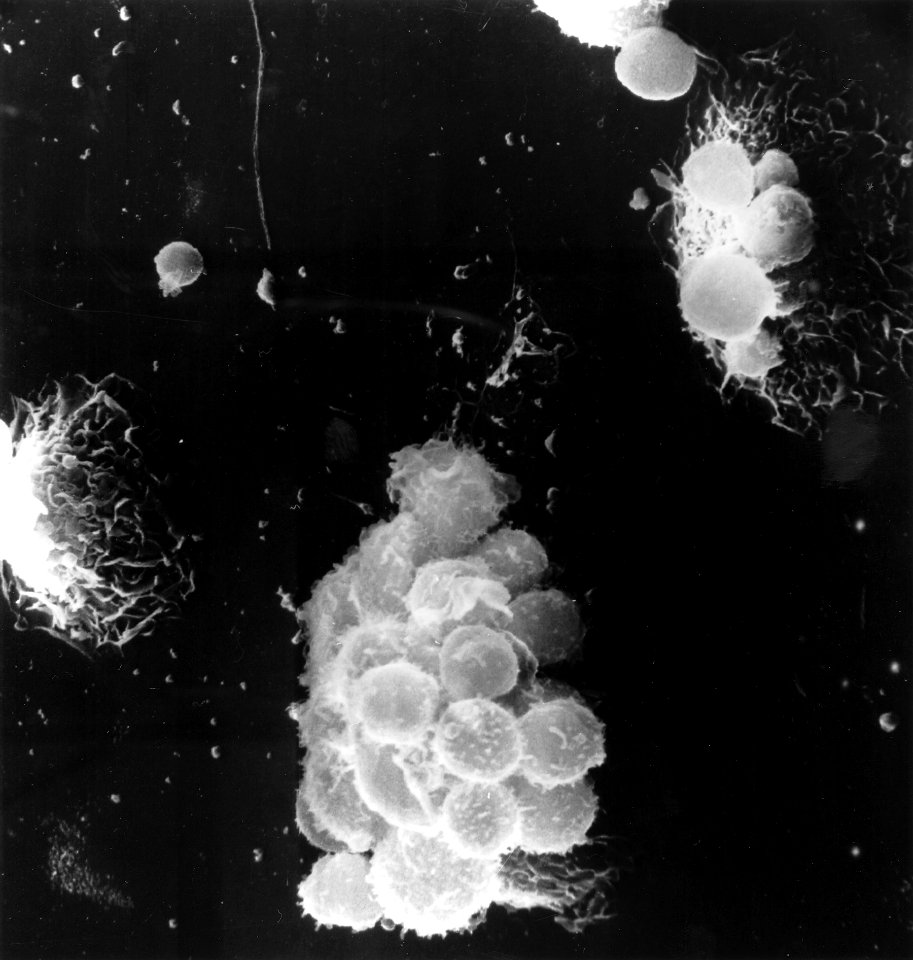 Macrophages and lymphocytes (1)