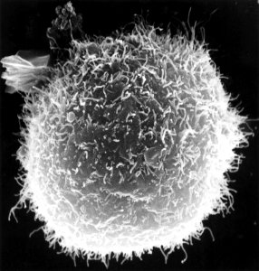 Macrophages and lymphocytes