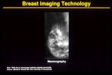 Mammogram (abnormal) photo