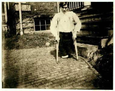 Monongah, W. Va. Nola McKinney, Secretary, 1910, West Virginia Child Labor Committee. Frank P......., whose legs were cut off by a motor car in a coal mine in West Virginia when he was 14 LOC cph.3a24703
