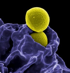 MRSA, Ingestion by Neutrophil photo