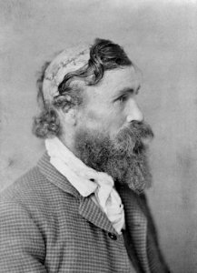 Robert McGee, scalped as a child by Sioux Chief Little Turtle in 1864