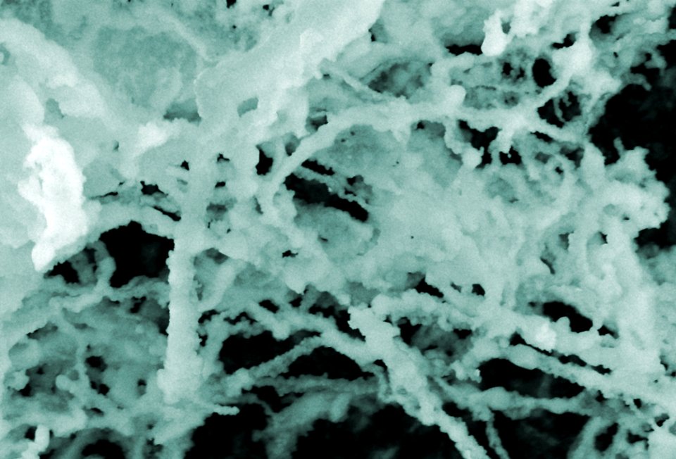 Nanoparticle-Protein Interactions (5941039768)