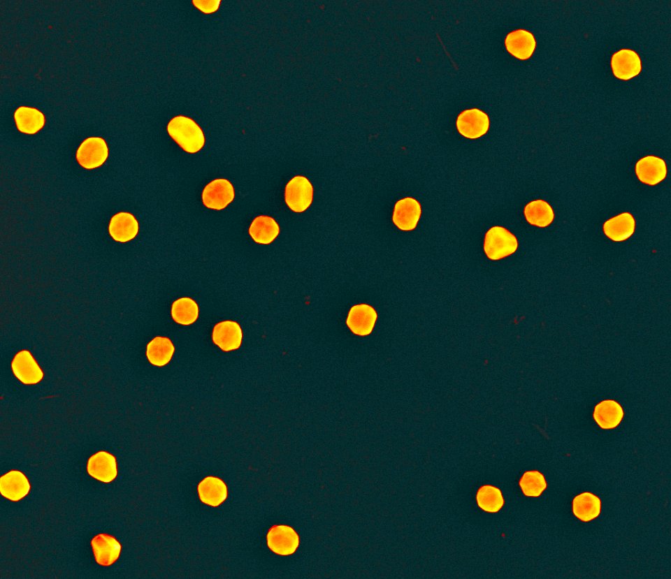 Nanoparticles; scanning electron micrograph (5887833046)