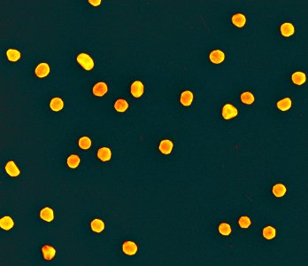 Nanoparticles; scanning electron micrograph (5887833046)