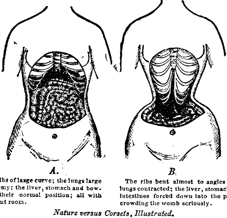 Nature versus corsets, illustrated LCCN2002716762