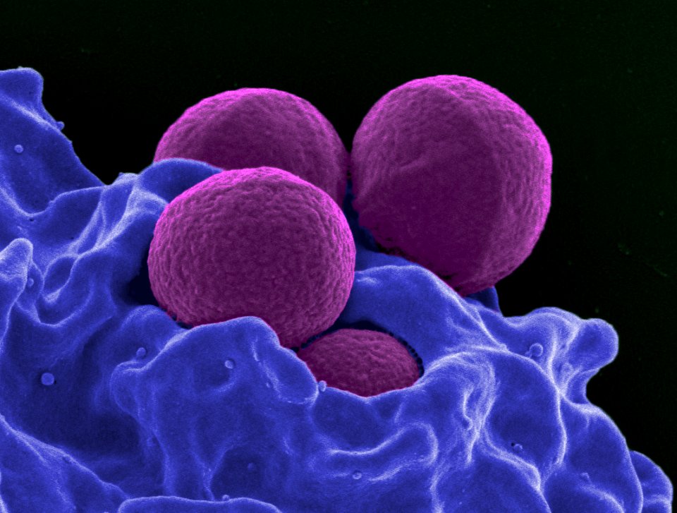 Neutrophil MRSA II