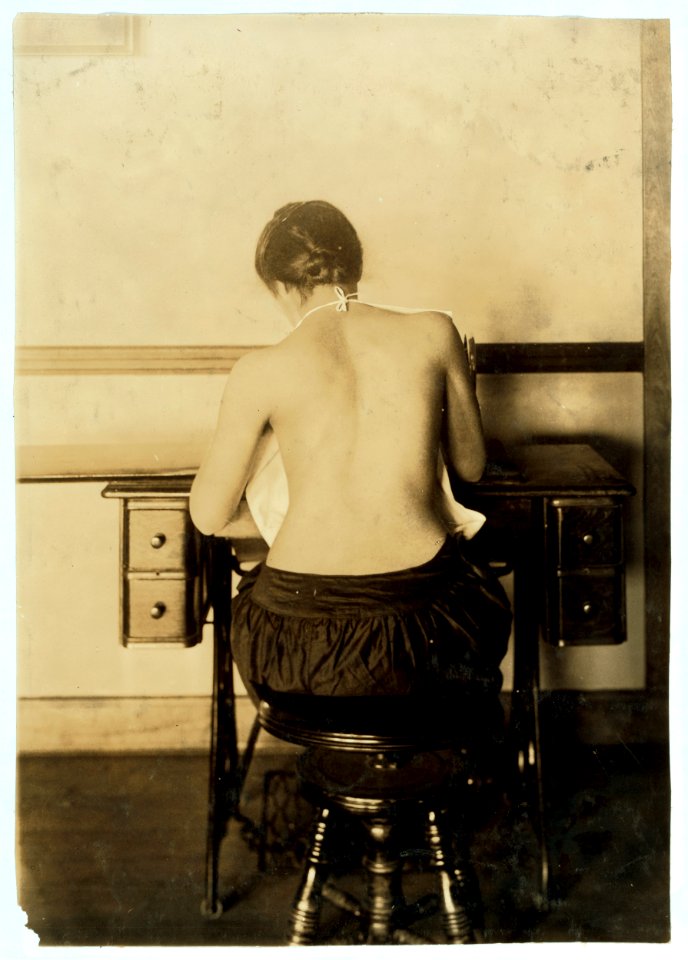 Mildred Benjamin, 17 years old. Right dorsal curvature. Scoliosis. Right shoulder higher than left. Shows incorrect position required to perform this kind of work. Stopping use of right arm. LOC nclc.05149
