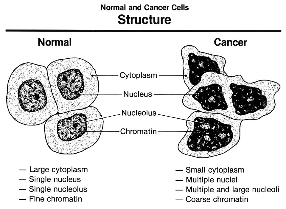 Normal and cancer cells structure
