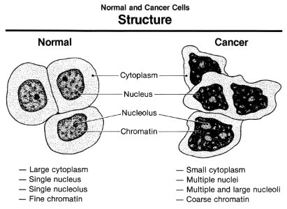 Normal and cancer cells structure photo