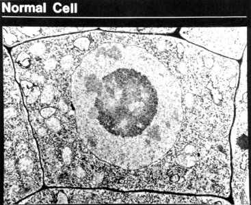 Normal cell photo