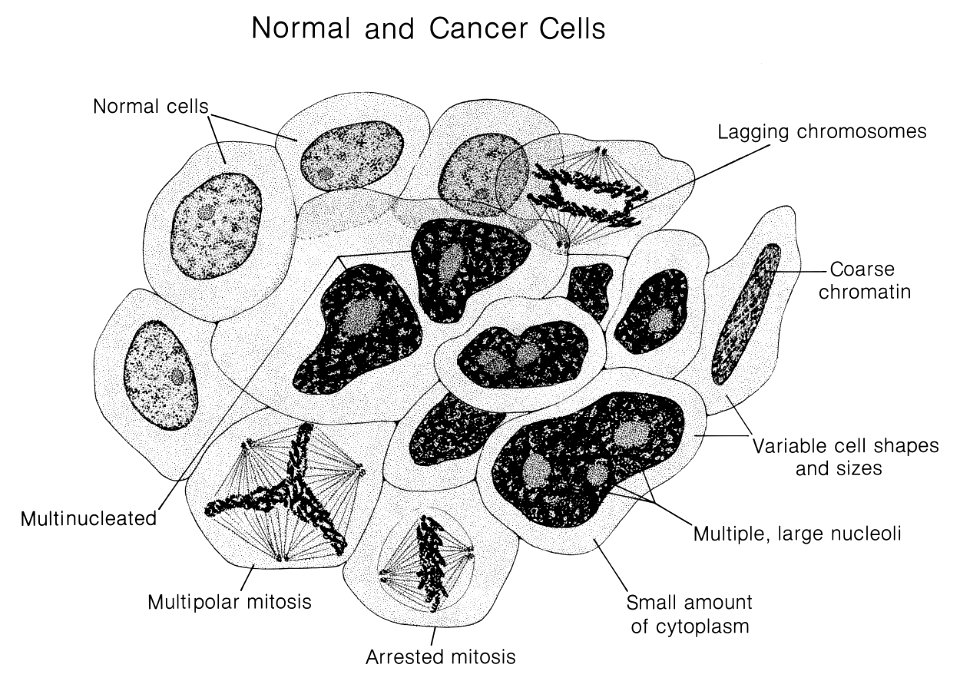 Normal and cancer cells (labeled) illustration