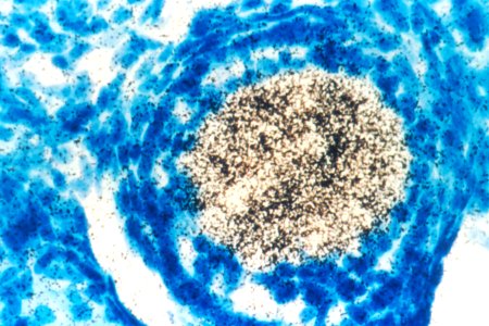 Oncogene (1)