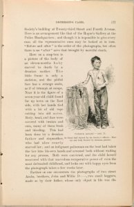 Patrick Kieley - age 11 As found half starved by the Society's officers. Face cut and body bruised by inhuman parents. LCCN2012647171