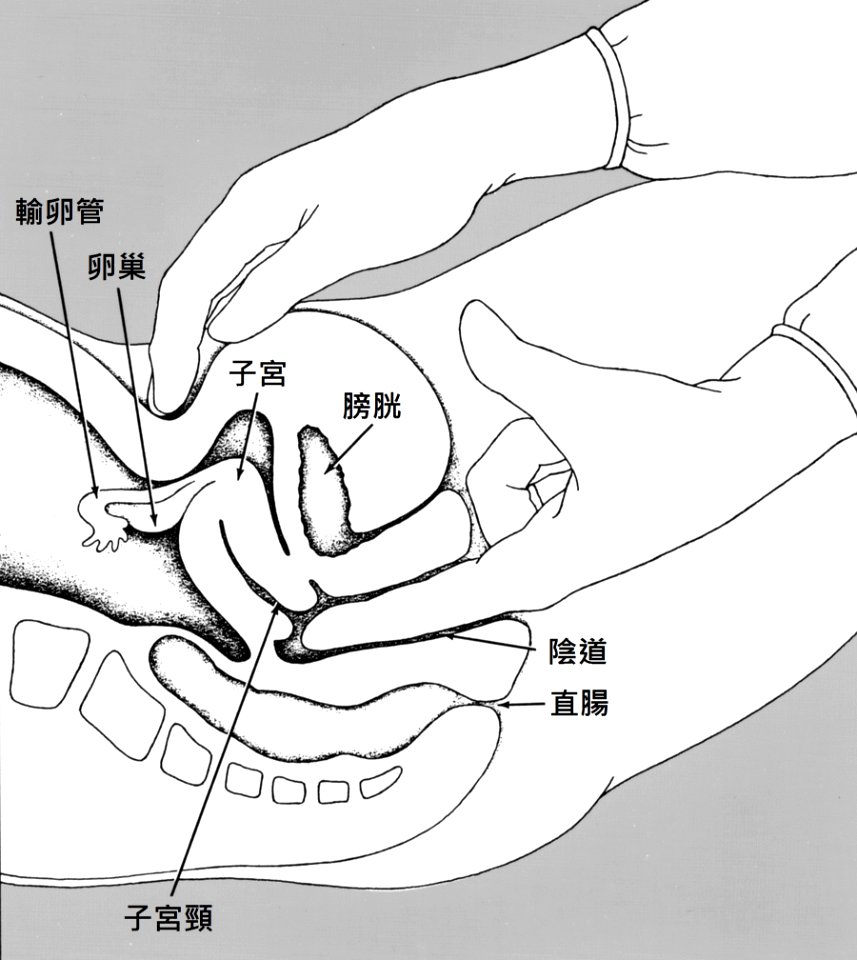 Pelvic exam nci-vol-zh-1786-300 photo