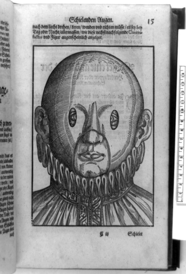 Person with crossed eyes wearing corrective mask, head-and-shoulders view LCCN92517450