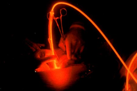 Photodynamic therapy (red)