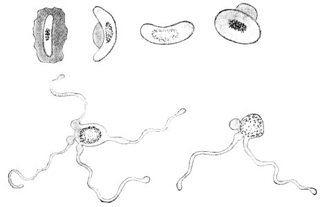 PSM V50 D655 Aestivo autumnal malarial fever characteristics photo