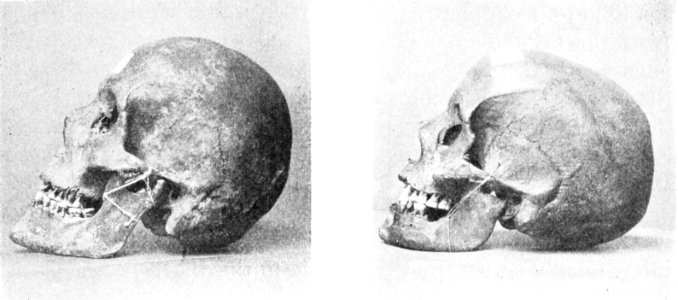 PSM V52 D333 Brachycephalic and dolichocephalic types from the coast of zeeland photo