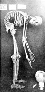 PSM V50 D507 Ossified skeleton of an aged elder from robles rancheria