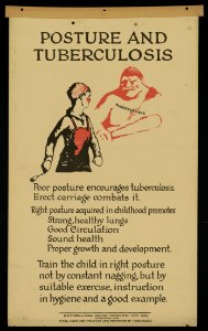 Posture and tuberculosis LCCN2014647542