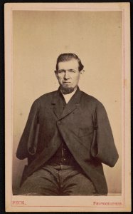 Private George W. Warner of Co. B, 20th Connecticut Infantry Regiment with amputated arms) - Peck, photographer LCCN2015650819 photo