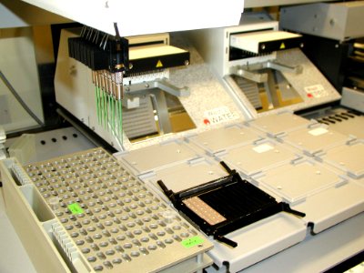 Protein pattern analyzer (2) photo