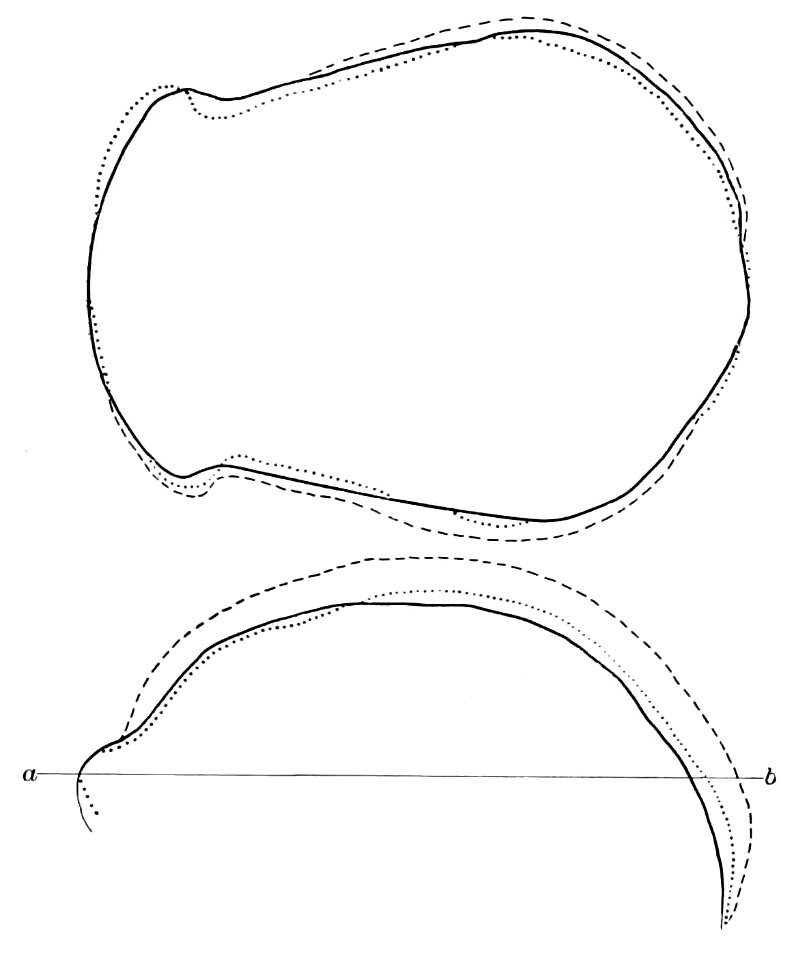 PSM V44 D636 Superimposed drawings of skull outlines